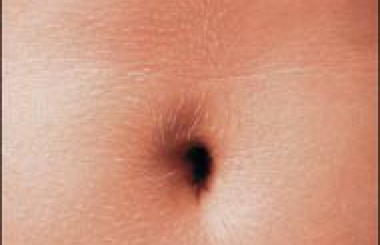 Sex